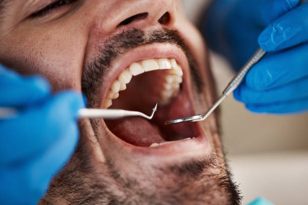 Best Broken or Chipped Tooth Repair in Ottumwa, IA